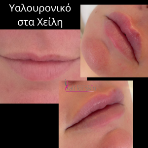 A16F43F1-7233-4A33-B062-A41B360D1738